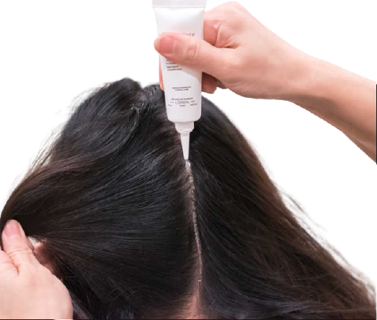 Scalp Treatment